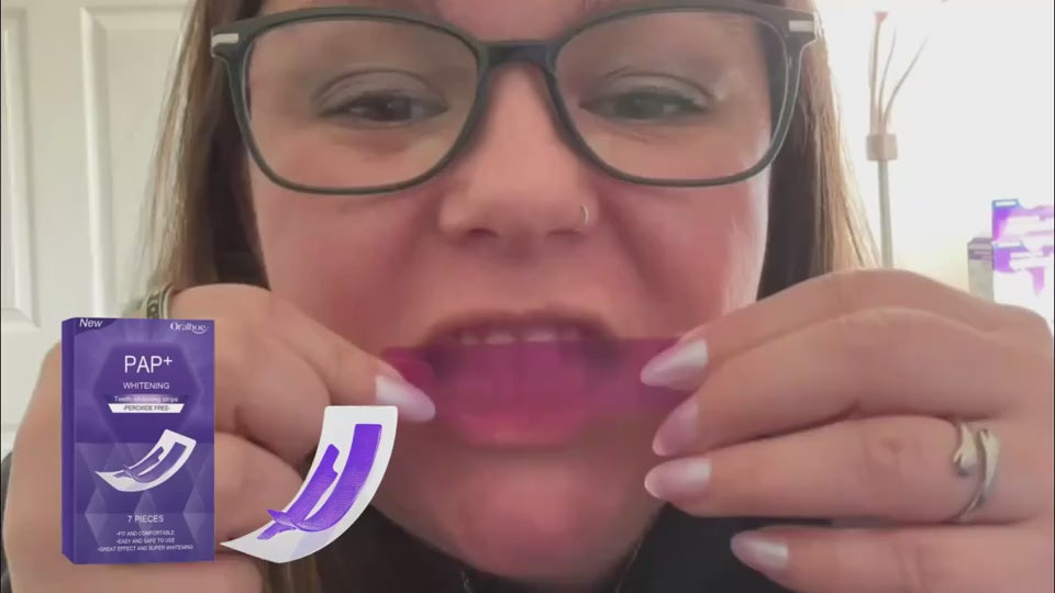 Advanced Teeth Whitening Strips (Purple Formula)