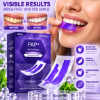 Advanced Teeth Whitening Strips (Purple Formula)
